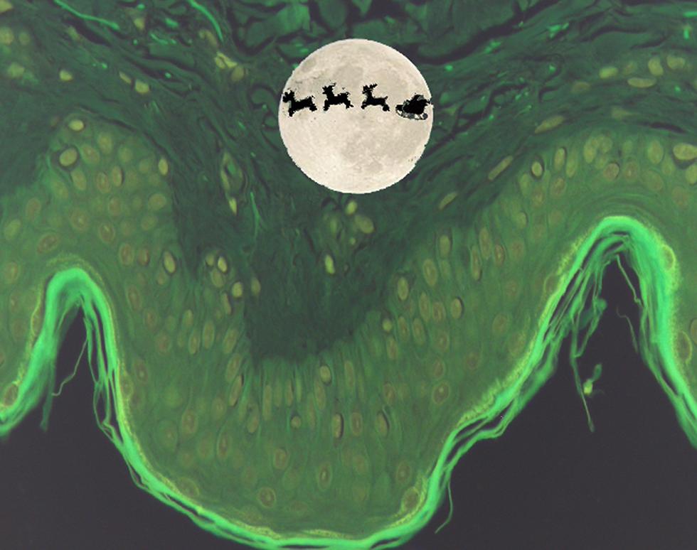 Santa in Skin Wonderland - Rute Fernandes